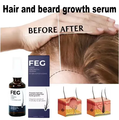 FEG Hair Growth Spray – Prevent Hair Loss & Stimulate Regrowth in 14 Days